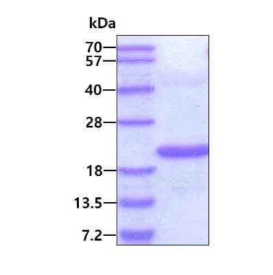 SDS-Page: Recombinant Human STAMP2/STEAP4 His Protein [NBP2-51607] - 3ug by SDS-PAGE under reducing condition and visualized by coomassie blue stain.